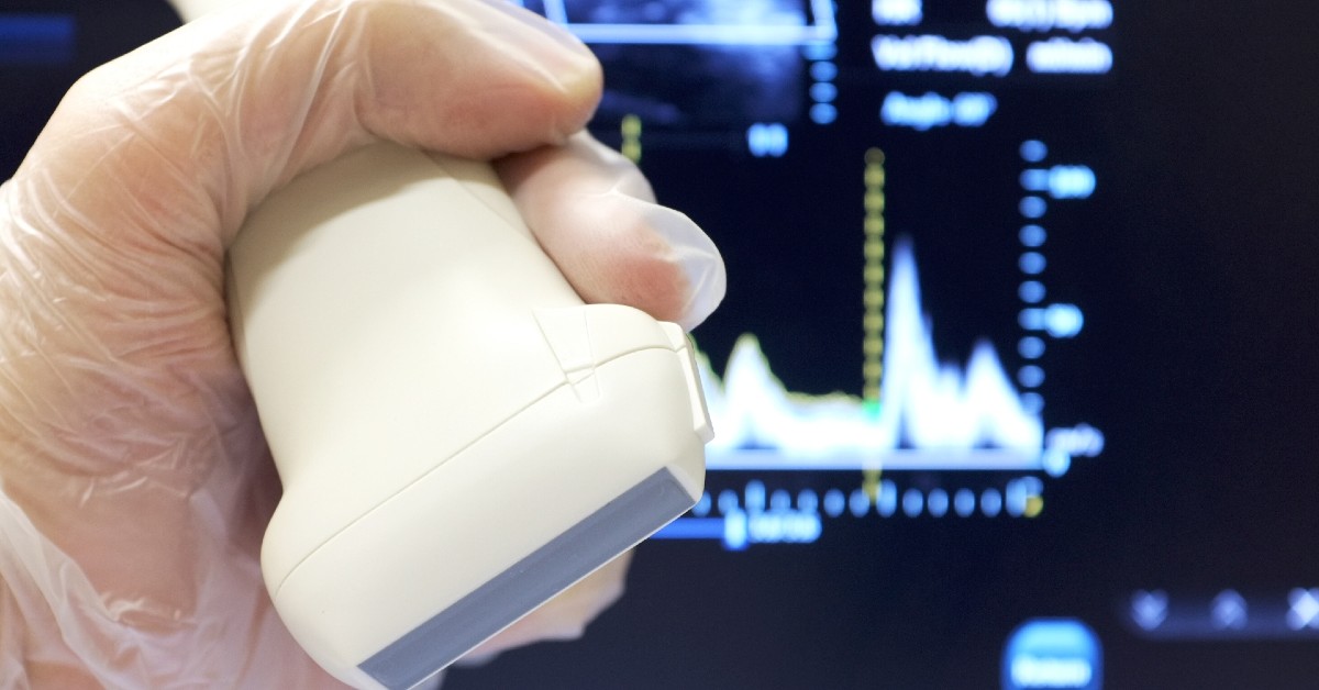 cand folosim ecografia Doppler