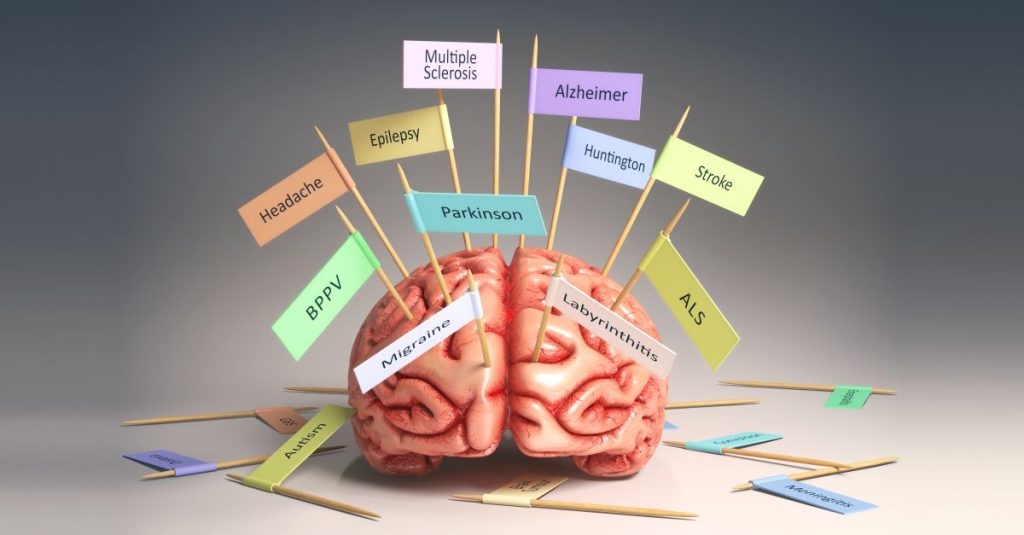 Timpul , masurat in neuroni pentru persoanele cu boli neurodegenerative