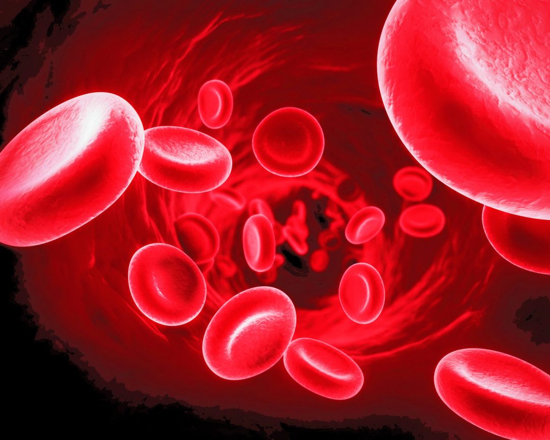 Ateroscleroza- sau -stenoza- arteriala