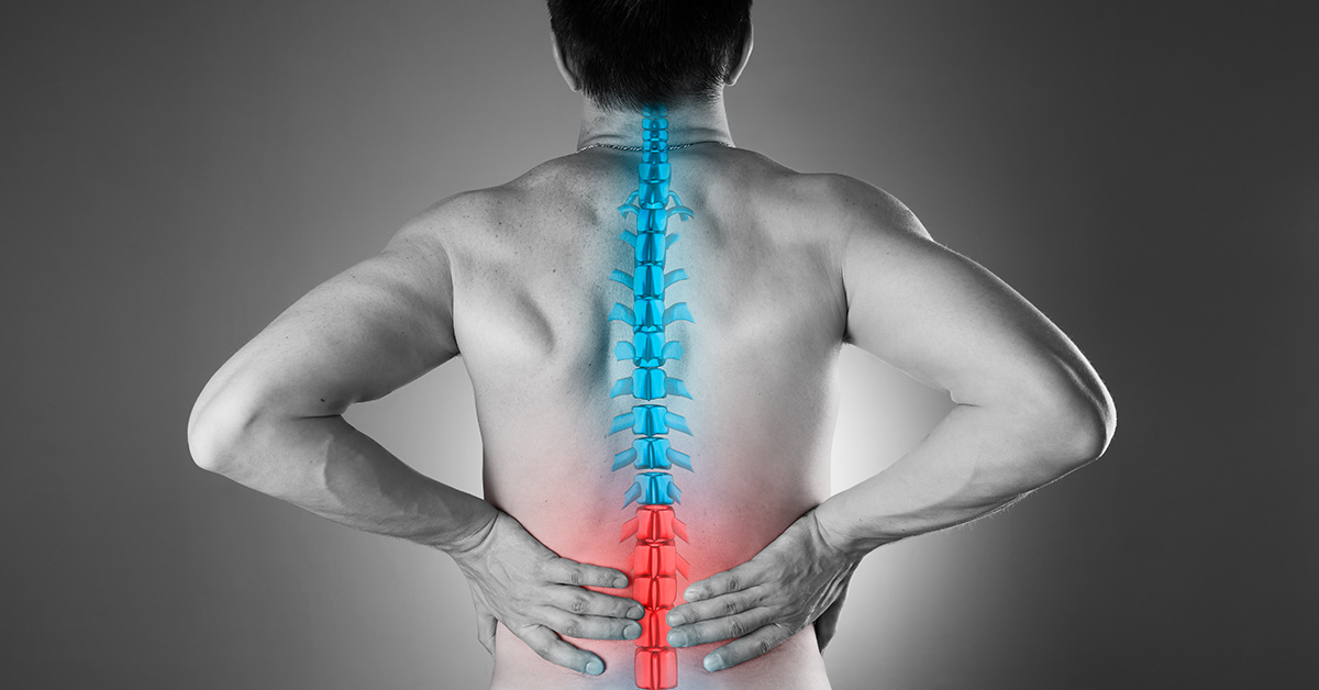 Lombosciatica, lumbago si alte tipuri de dureri de spate