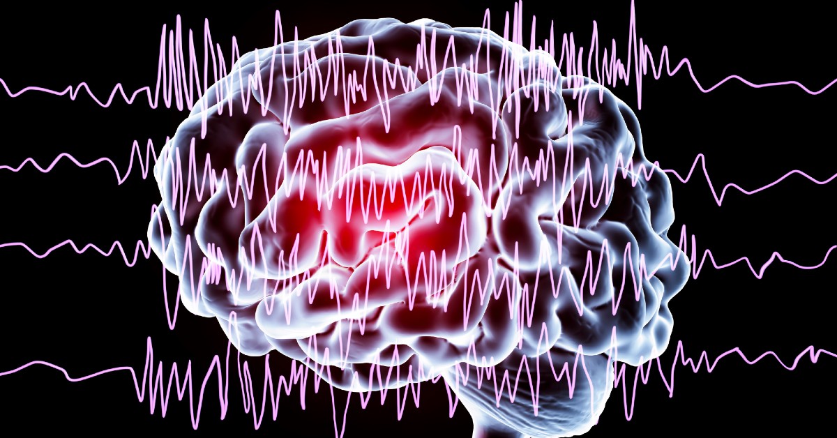 Crize focale de epilepsie, București