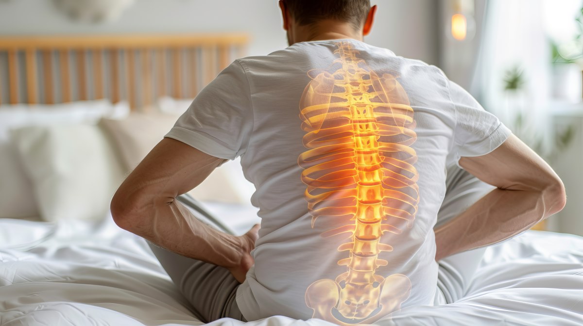 spondilita anchilozanta