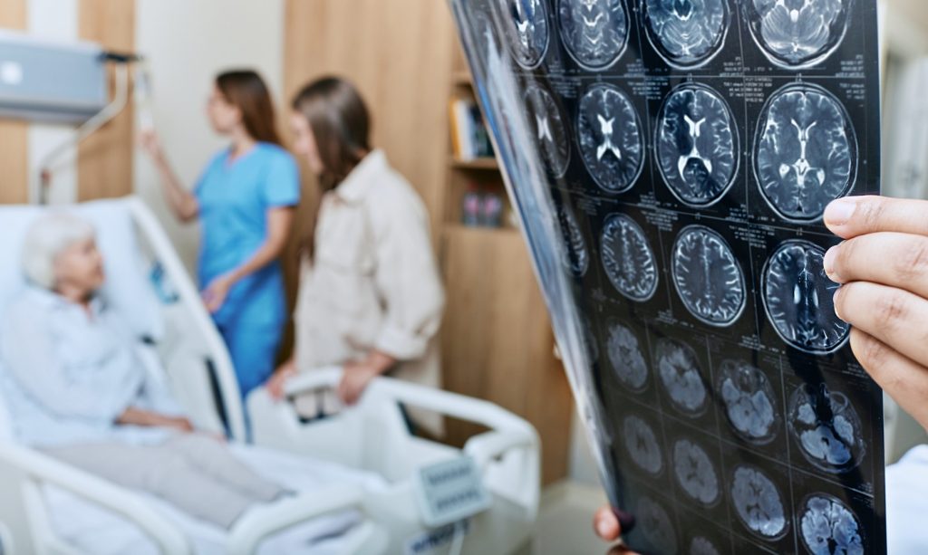 Cauzele accidentului vascular cerebral