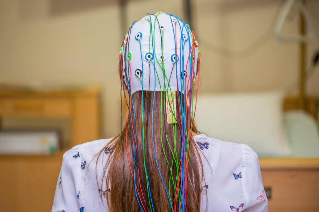 Ghid de pregătire Electroencefalogramă (EEG)