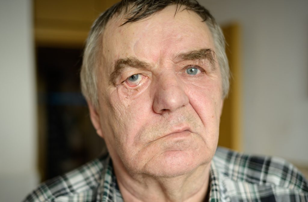 În cât timp trece pareza facială. Tratamentul poate grăbi vindecarea