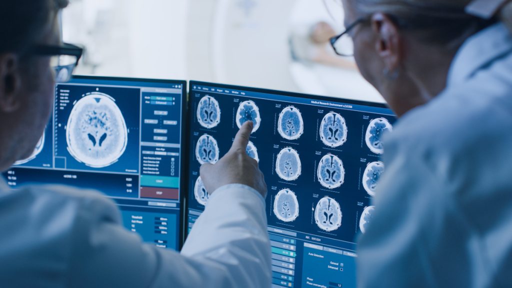 Rata de supraviețuire pentru meningiom. De ce e important să ai alături de tine o echipă de neuro-oncologie