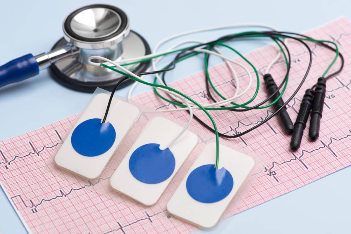 rezultate electrocardiograma